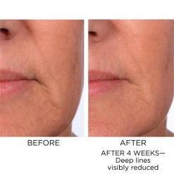 Elizabeth Arden Prevage Progressive Renewal Treatment 13 Elizabeth Arden Prevage Progressive Renewal Treatment -Bobbi Brown sales 05639130 02 ai