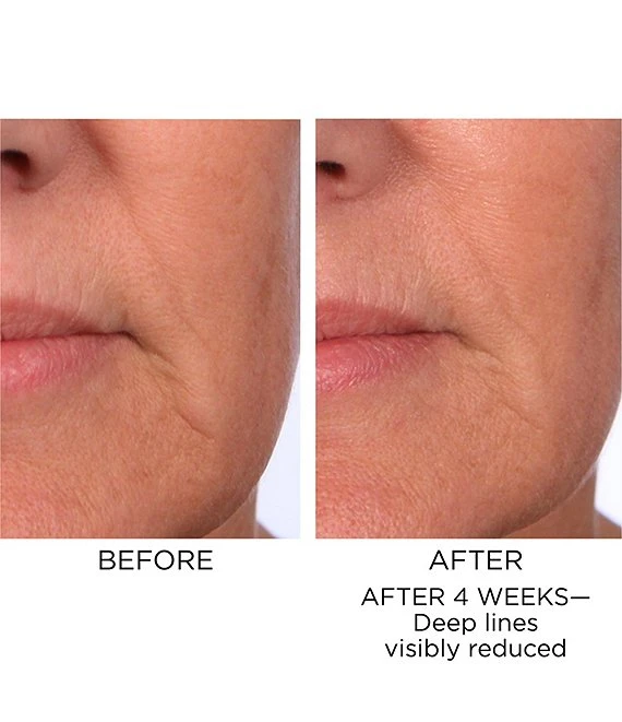 Elizabeth Arden Prevage Progressive Renewal Treatment 8 Elizabeth Arden Prevage Progressive Renewal Treatment - Afbeelding 6