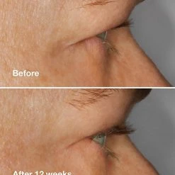 Clinique : High Impact™ Lash Amplifying Serum 11 Clinique : High Impact™ Lash Amplifying Serum -Bobbi Brown sales 20235703 03 ai