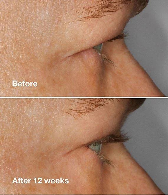 Clinique : High Impact™ Lash Amplifying Serum 7 Clinique : High Impact™ Lash Amplifying Serum - Afbeelding 5