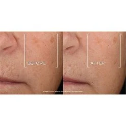 Lancome Renergie H.C.F.Triple Serum -Bobbi Brown sales 20237454 04 ai