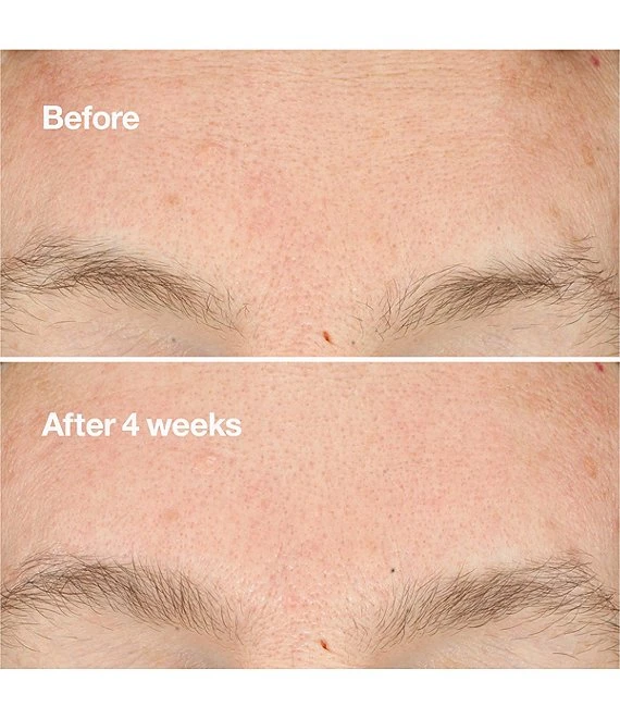 Clinique Clarifying Do-Over Peel 4 Clinique Clarifying Do-Over Peel - Afbeelding 2